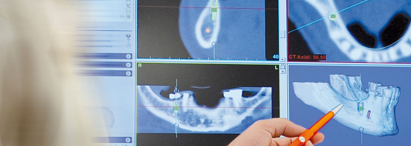 Zahnimplantate in Scheeßel